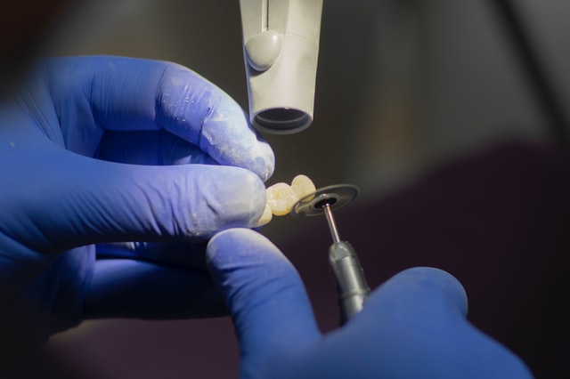 When did dental implants start?